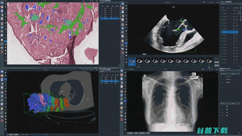 深圳大学MUSIC实验室推出一款软件神器 大大提升医学影像AI标注的质量与一致性 (深圳大学牟林)
